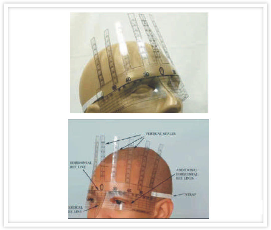 HAIR LINE SCALE (HL-01)